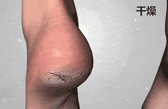 人试试这个外抹的方子一试就灵不朽情缘游戏网站址手足干裂的(图9)